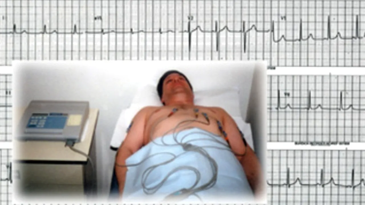 1-ekg 
