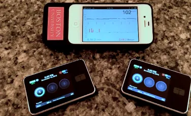 Idee ingenioasă a cercetătorilor: un iPhone a fost modificat pentru a crea un pancreas bionic