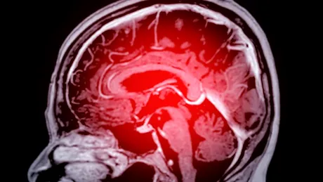 O nouă metodă de scanare cerebrală ar putea ajuta pacienții cu epilepsie rezistentă la medicamente