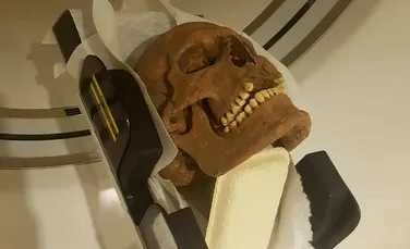 Craniile din epoca vikingă analizate cu raze X au dezvăluit ceva șocant