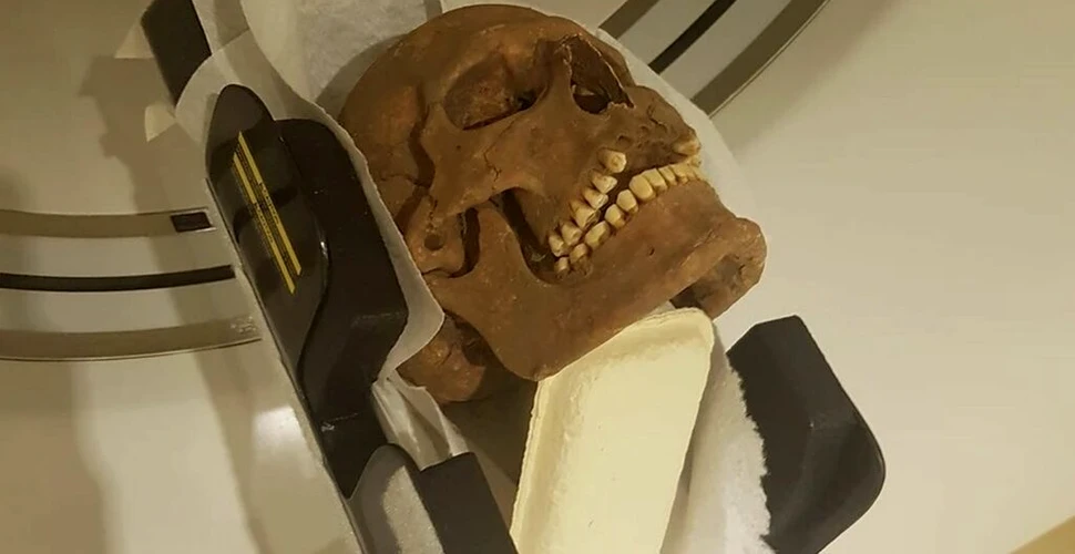 Craniile din epoca vikingă analizate cu raze X au dezvăluit ceva șocant