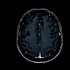 Un test de sânge îi poate ajuta pe medici să identifice mai bine severitatea leziunilor cerebrale