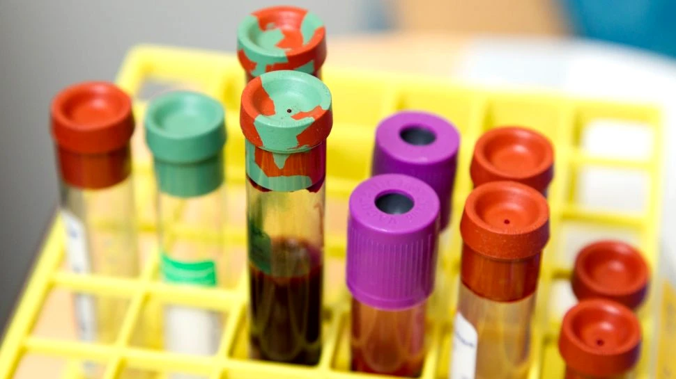 Un nou test poate găsi bacteriile rezistente la antibiotice din sângele unui pacient în doar o oră
