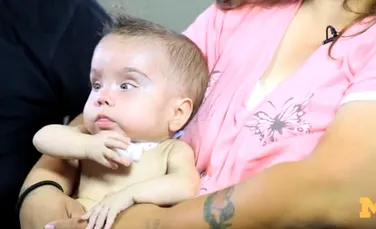 Imprimantele 3D salvează vieţi: un bebeluş a supravieţuit mulţumită unui dispozitiv medical printat 3D (VIDEO)
