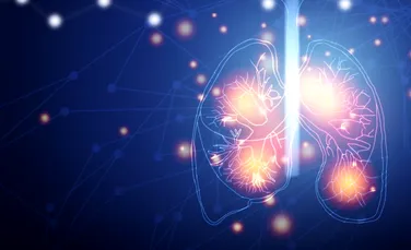 Un test bazat pe inteligență artificială poate detecta cancerul pulmonar cu o acuratețe de 90%