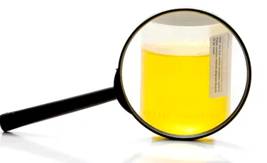 Sfârşitul unui mit medical: „Trebuie să reevaluăm tot ceea ce ştiam despre urina umană”, spun cercetătorii
