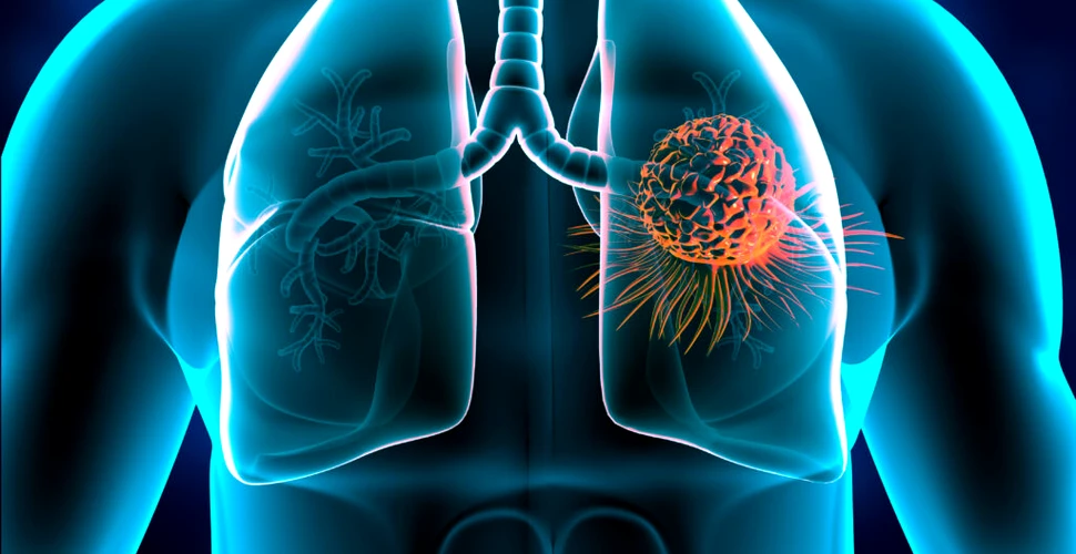 Oamenii de știință au descoperit cum declanșează poluarea cancerul pulmonar