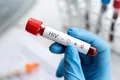 Despăgubiri pentru pacienții infectați cu HIV și hepatita C cu produse de sânge contaminate