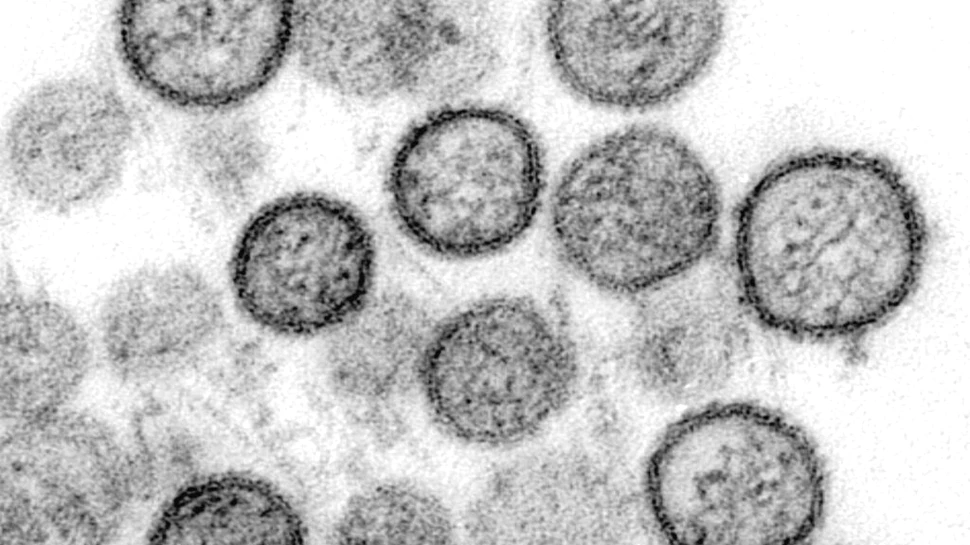OMS dă asigurări că focarul de hantavirus de pe vasul de croazieră „nu este începutul unei noi pandemii”
