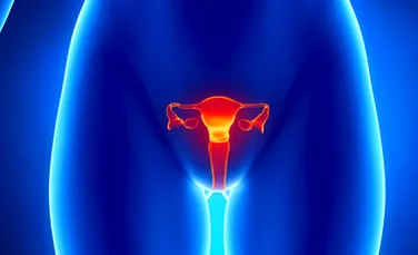 Endometrioza, boala care afectează din ce în ce mai multe femei
