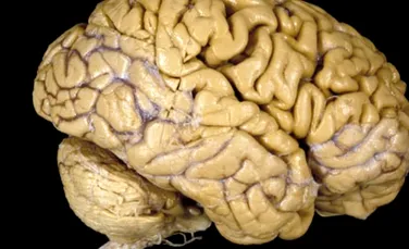 S-a descoperit cel mai vechi creier uman