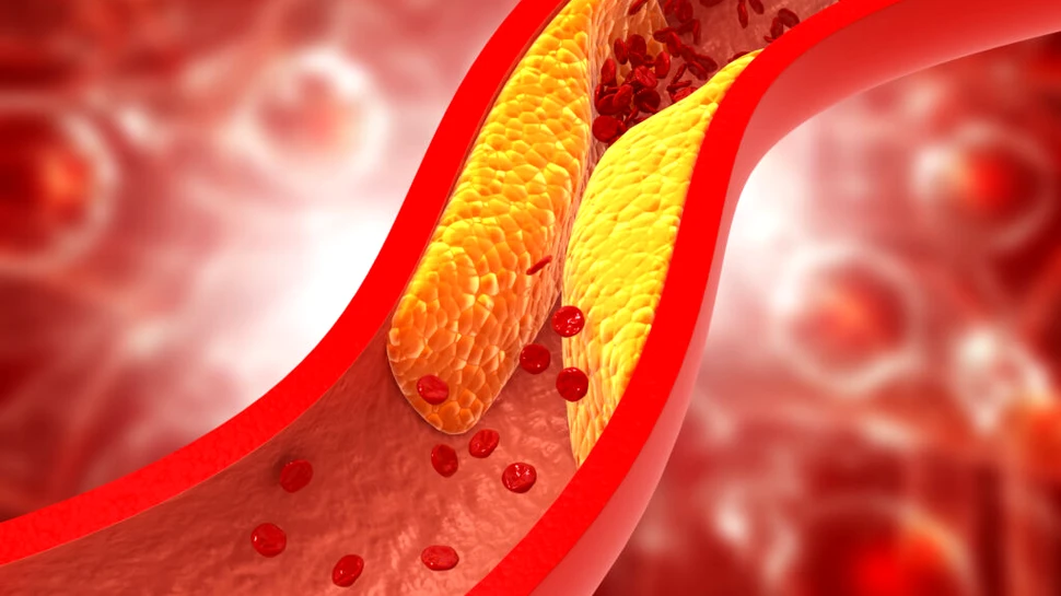 Un medicament împotriva obezității are un efect secret asupra cancerului