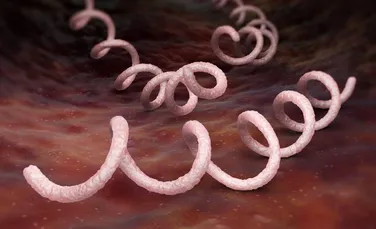 O singură genă diferită poate face ca sifilisul să treacă nedetectat pentru mai mulţi ani