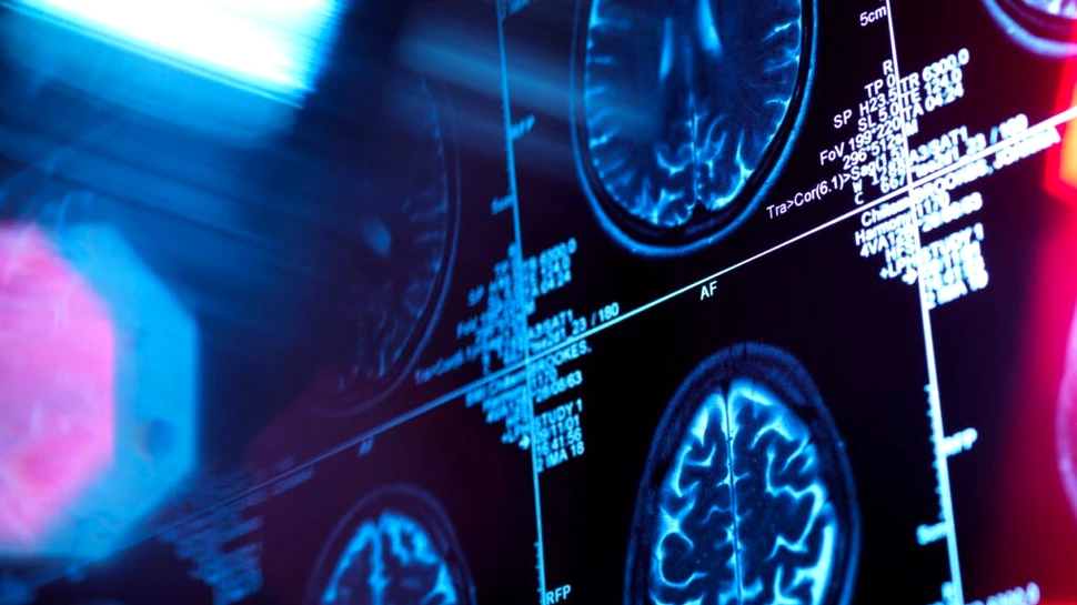 Un studiu pune la îndoială tot ce credeam că știm despre Alzheimer. Care ar fi de fapt cauza bolii?