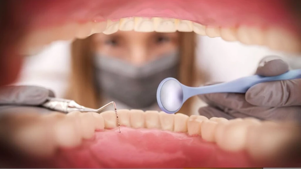 Bacteriile orale ar putea cauza atacuri de cord, sugerează un nou studiu