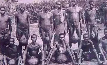 Ritualul SINISTRU al unui trib din Africa. În urma lui, testiculele bărbaţilor ajung la 80 de centimetri – FOTO+VIDEO