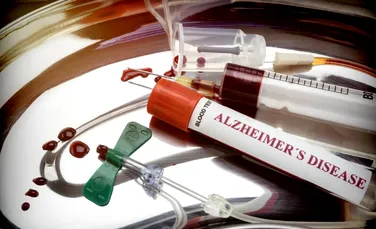 Un test de sânge va putea detecta mai repede boala Alzheimer