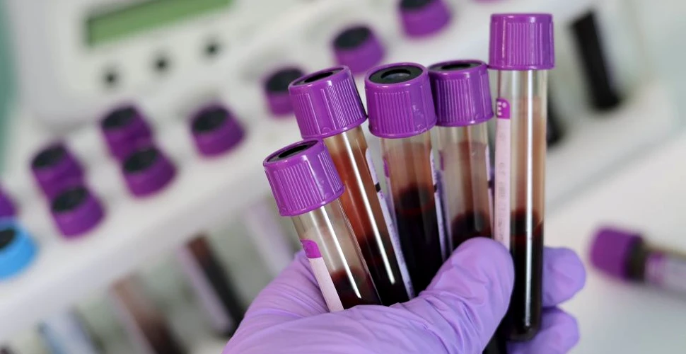 Testele pentru un nou vaccin anti-HIV au fost oprite după vaccinarea a 5.000 de oameni