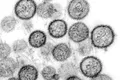 OMS dă asigurări că focarul de hantavirus de pe vasul de croazieră „nu este începutul unei noi pandemii”