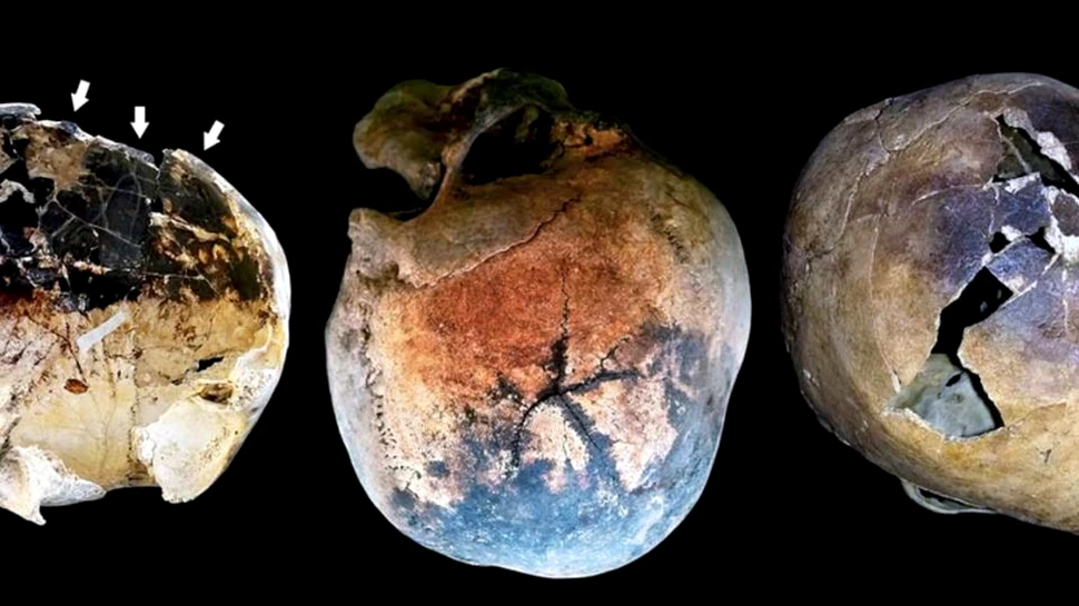 Moartea oribilă a victimelor erupţiei vulcanului Vezuviu. Fluidele corpului s-ar fi evaporat din cauza temperaturii extreme