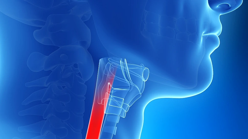 Premieră pentru România şi Europa de Sud-Est: o operaţie inovatoare pentru o boală rară la esofag