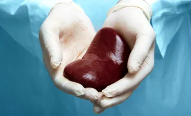 A murit bărbatul cu primul transplant de rinichi de porc modificat genetic din lume