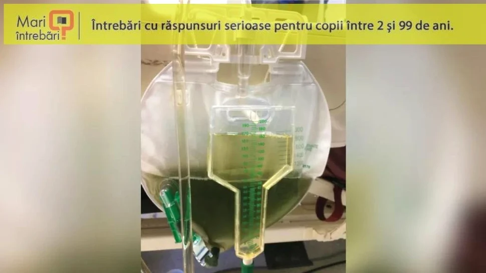 De ce urina unui om poate deveni verde?