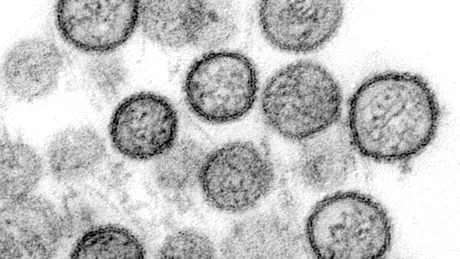 OMS dă asigurări că focarul de hantavirus de pe vasul de croazieră „nu este începutul unei noi pandemii”