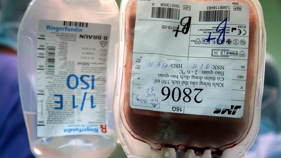 Transfuziile de sânge ar putea reduce daunele cauzate de către atacurile vasculare cerebrale