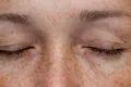 Paradoxul pistruilor: De la „semne ale diavolului” la cel mai dorit trend de beauty. Ce spune știința despre petele care fascinează lumea?