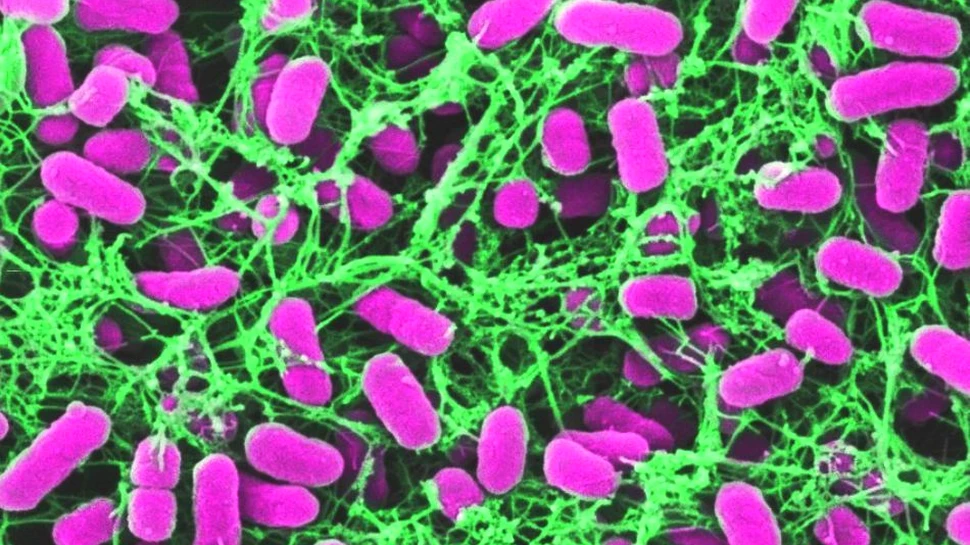 „Plasele de păianjen” din intestinul uman capturează microbii periculoşi