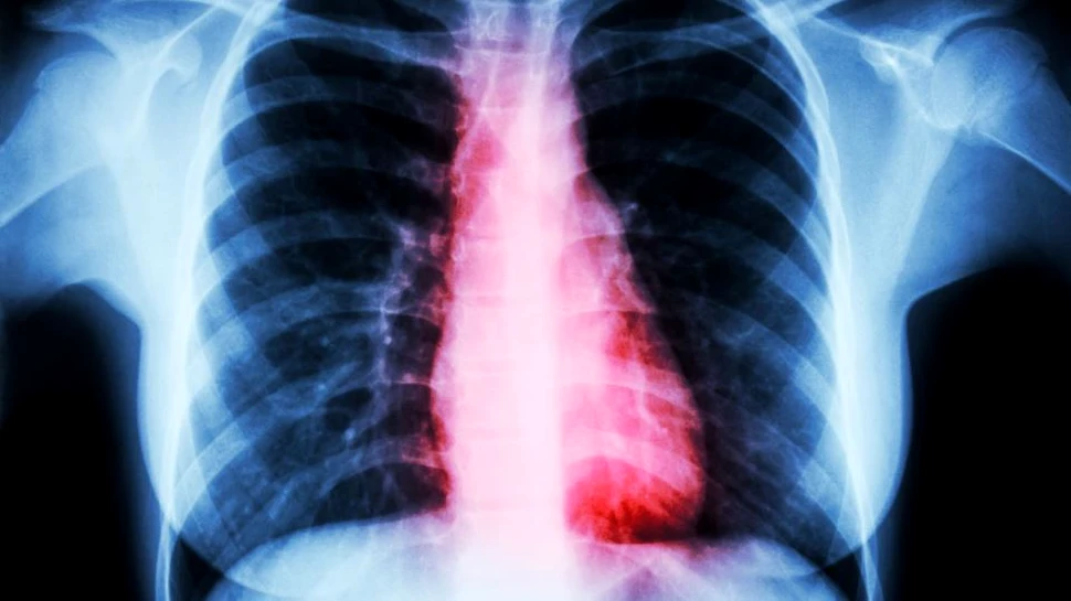 Legătura dintre inimă şi creier, mai puternică decât ştiam