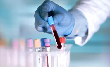 Cercetarea cancerului este inundată de studii false, avertizează o analiză alarmantă