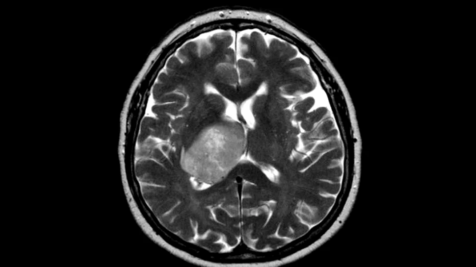 Revoluţie în imagistica medicală: un nou tip de scaner poate depista cancerul în câteva secunde