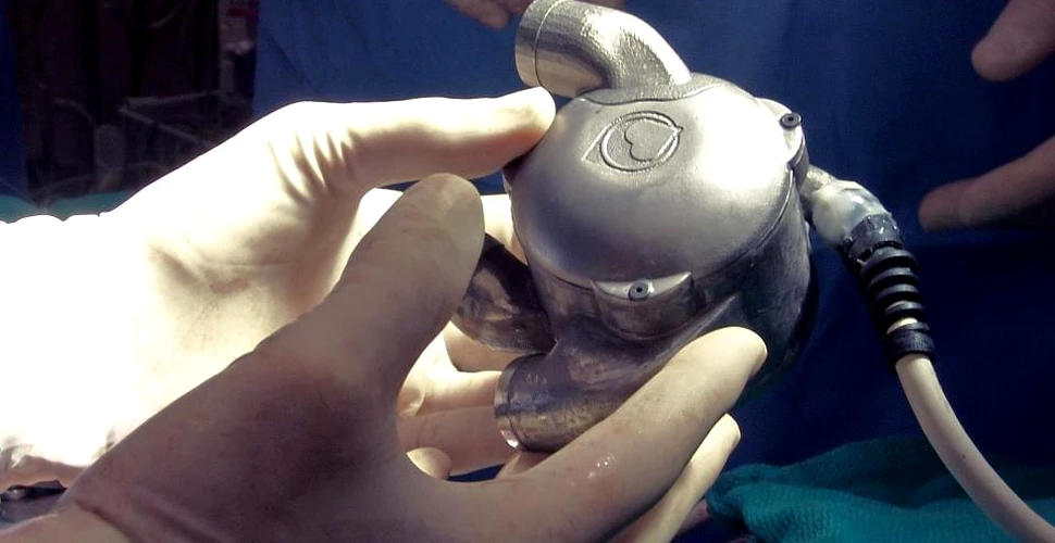 Cum funcţionează prima inimă bionică din lume. Nu are puls şi este făcută din titan – VIDEO