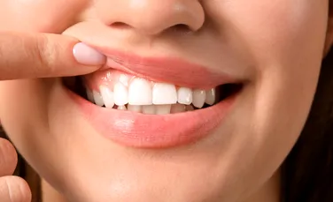 Un medicament pentru regenerarea dinților ar putea fi disponibil în următorul deceniu