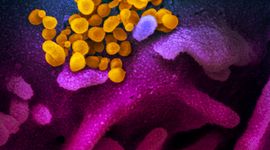 butter Tactile sense dividend Cum arată coronavirusul din China care s-a răspândit în întreaga lume?  Primele imagini obţinute de cercetători