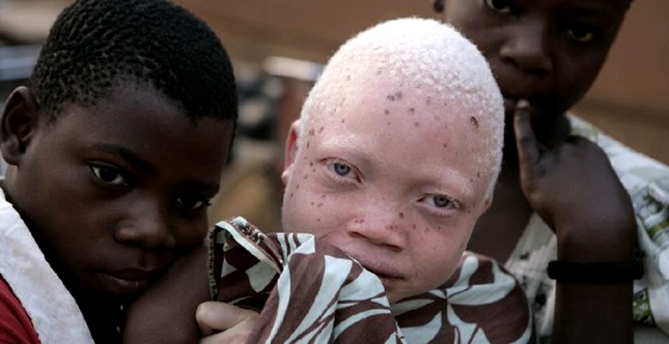 Albinosii sunt persecutati in Tanzania