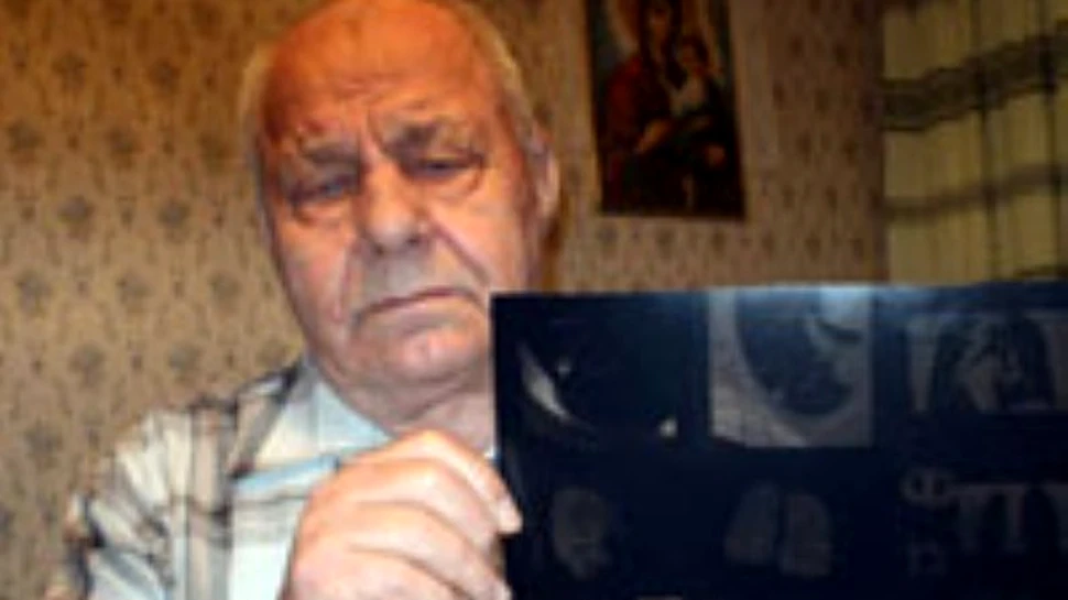 Omul care a trait 68 de ani cu un glont in plaman
