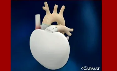 În curând, am putea purta în piept inimi artificiale (VIDEO)