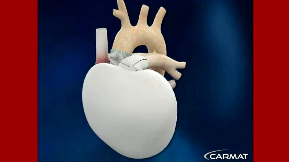 În curând, am putea purta în piept inimi artificiale (VIDEO)