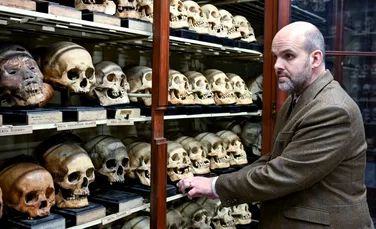 „Camera craniilor” de la Universitatea din Edinburgh dezvăluie o istorie neplăcută