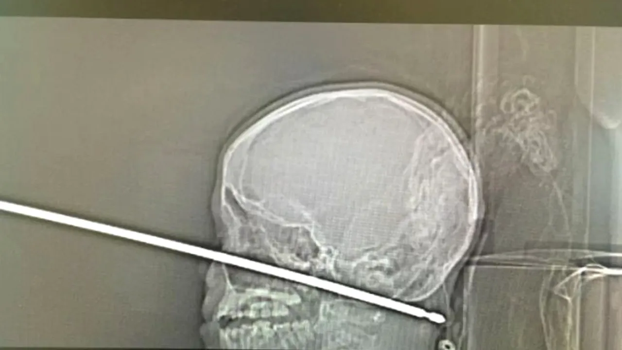 1-radiografie 