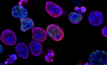 Noi cercetări dezvăluie motivul pentru care unele tumori conțin celule diferite