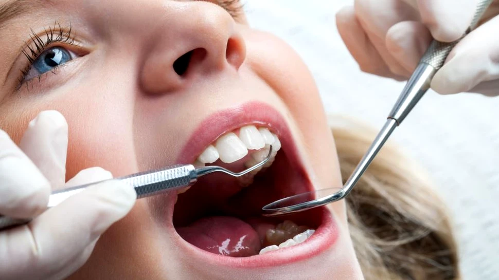 Peste 500 de români au fost diagnosticaţi doar în 2016 cu cancer oral. Care sunt simptomele acestei maladii