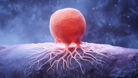 Un nou studiu amplu identifică noi ținte terapeutice potențiale pentru cel mai frecvent tip de cancer colorectal