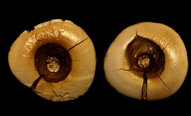 Tratamente stomatologice există de 13.000 de ani, conform unei noi descoperiri