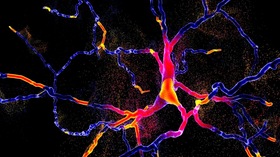 Cercetătorii lucrează la bacteria ce va produce un medicament pentru Parkinson