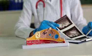 Mamografiile de rutină pot oferi indicii importante despre riscul cardiac