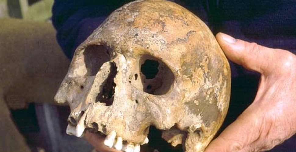 A fost descoperit craniul cu o formă bizară al unei femei